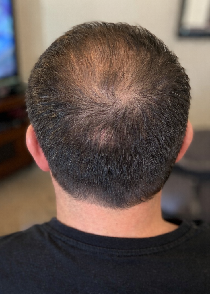 Before and after comparison of a person's hair on the back of their head.